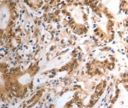 RAD50 Polyclonal Antibody - 3