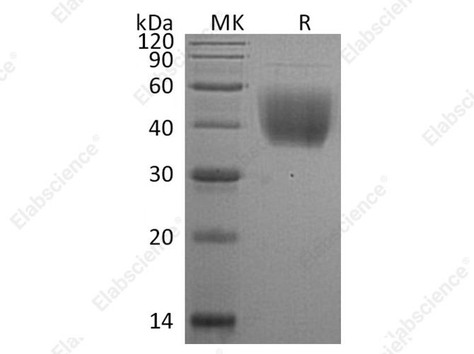 Recombinant Rat CD80/B7-1 Protein (His Tag) - 1
