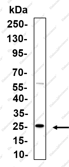 Recombinant SOCS-3 Monoclonal Antibody - 1