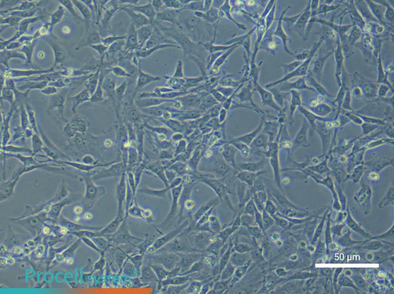 Rat Corpus Cavernosum Smooth Muscle Cell Complete Medium - 4