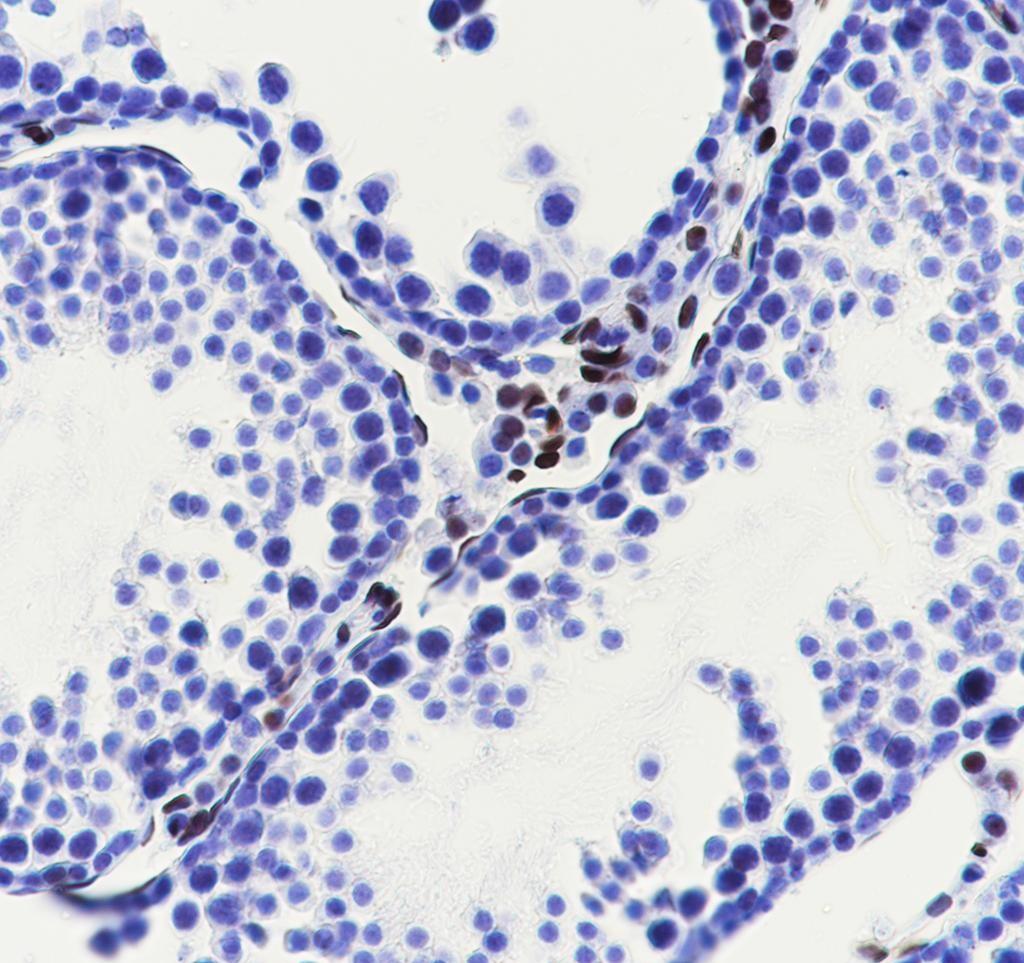 Recombinant COUP-TFII Monoclonal Antibody - small - 5