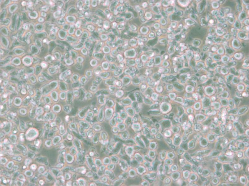MM.1S Cell Complete Medium - 6