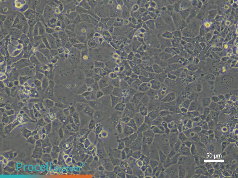 Rat Coronary Artery Endothelial Cells - 5