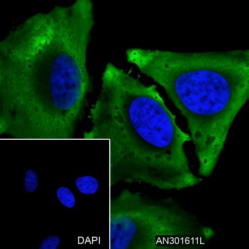 Recombinant NSE Monoclonal Antibody - 2