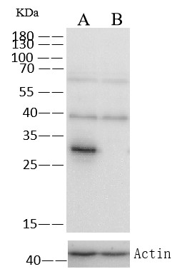SULT1A1 Monoclonal Antibody - small - 3