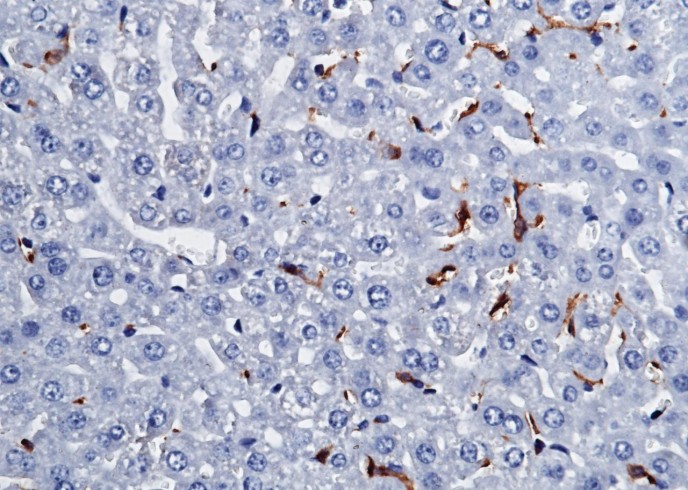 Recombinant CD64/FCGR1 Monoclonal Antibody - small - 2