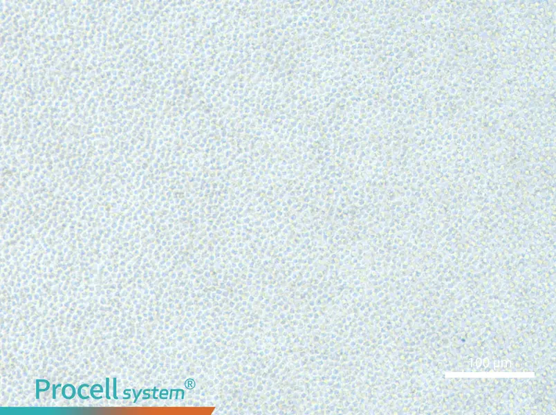 OCI-AML-2OCI-AML-2 - 2