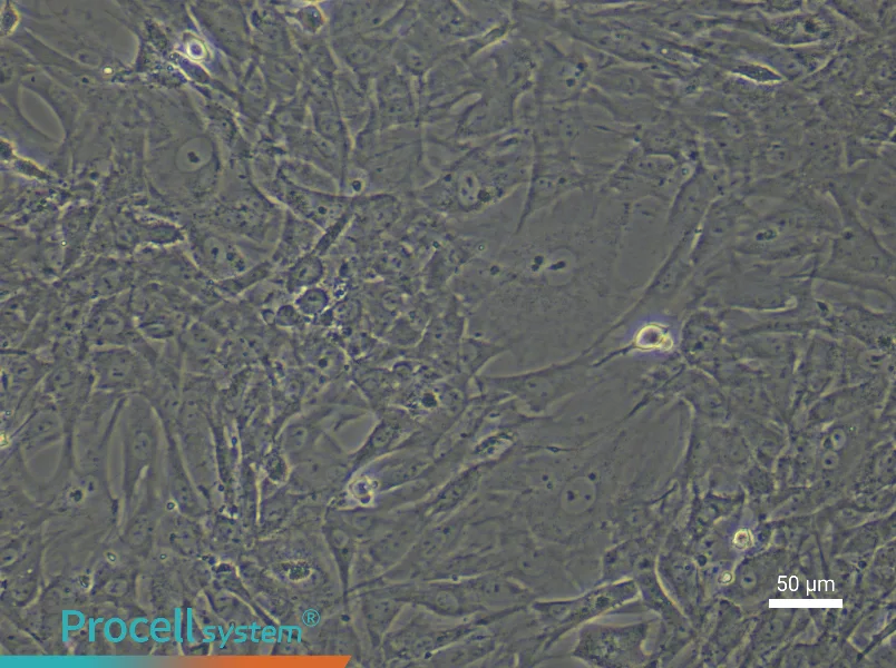 Rat Skeletal Muscle Fibroblast Complete Medium - 6
