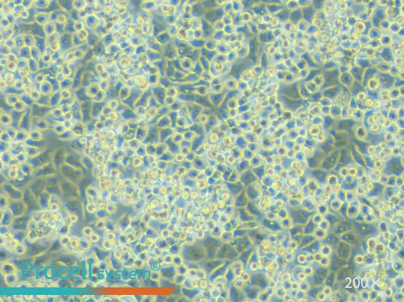 NCI-H2122 Cell Complete Medium - 6