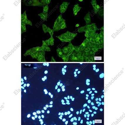 Recombinant EGFR/HER1/ErbB1 Monoclonal Antibody - 6