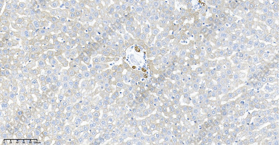 Recombinant Cytokeratin 18 Monoclonal Antibody - 2