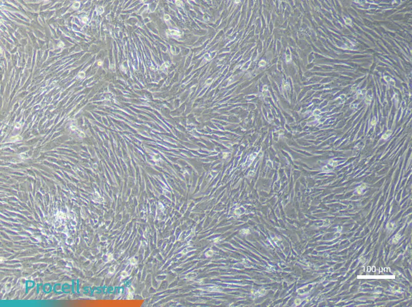Mouse Pancreatic Stellate (Primary cell immortalization) Cell Complete MediumMouse Pancreatic Stellate (Primary cell immortalization) Cell Complete Medium - 2