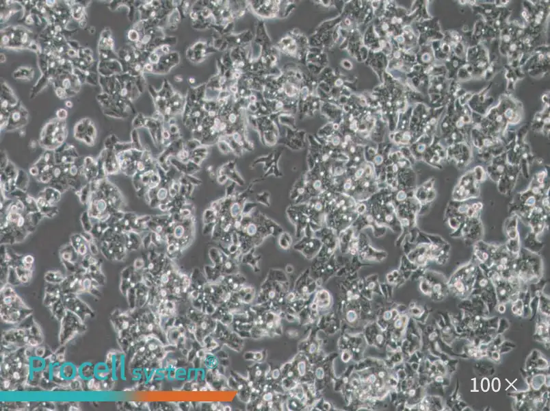 OE19 Cell Complete Medium - 1
