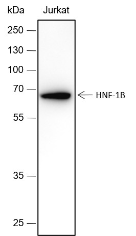 Recombinant HNF-1B Monoclonal Antibody-searchlist-1