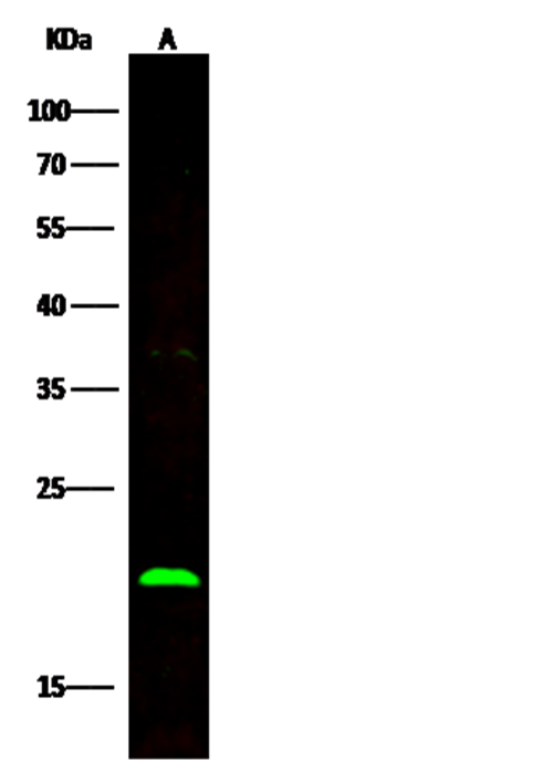 Recombinant BID Monoclonal Antibody