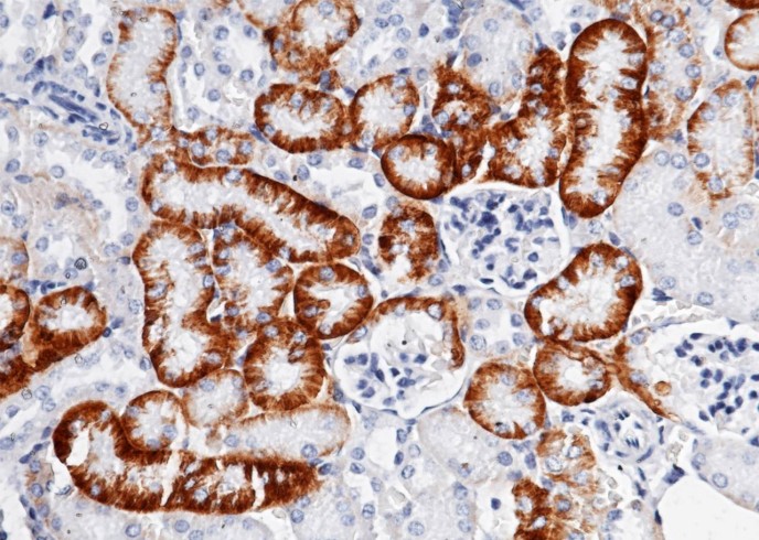 Recombinant SLC3A2/CD98 Monoclonal Antibody-searchlist-1