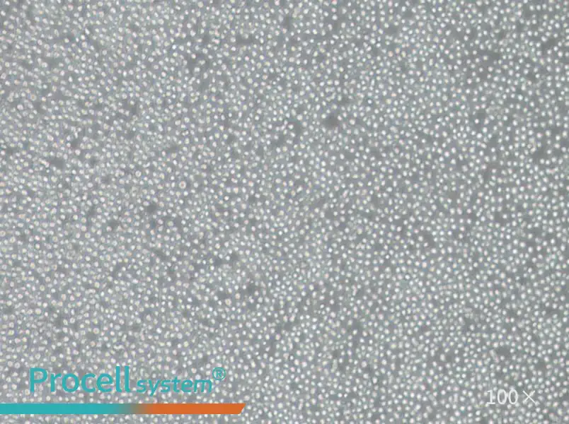 OCI-AML-3 Cell Complete Medium - 1