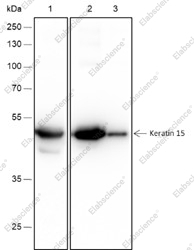 Recombinant Keratin 15 Monoclonal Antibody - 2