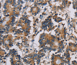 MRPL39 Polyclonal Antibody - 2