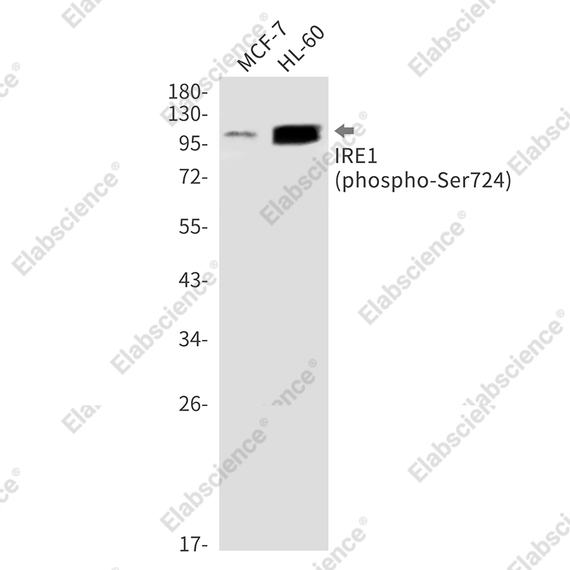 Recombinant Phospho-IRE1 (Ser724) Monoclonal Antibody - 1
