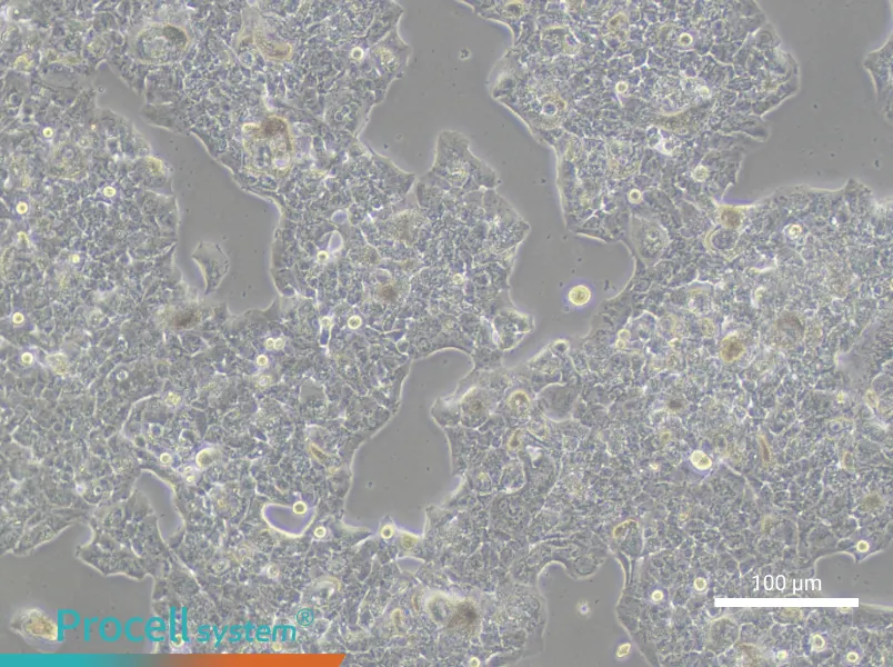 HCC1419 Cell Complete MediumHCC1419 Cell Complete Medium - 1