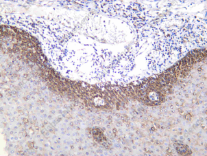 Recombinant Cortactin Monoclonal Antibody - 2