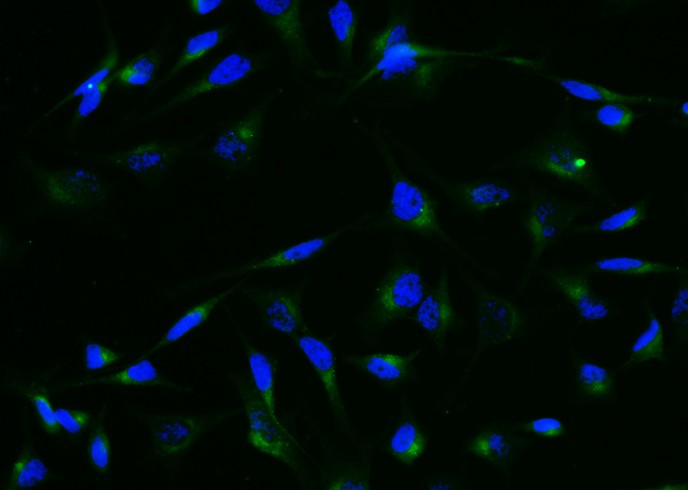 Granulin/GRN/Progranulin Monoclonal Antibody-searchlist-1