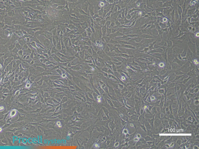 Human Chondrocyte (Primary cell immortalization) Complete MediumHuman Chondrocyte (Primary cell immortalization) Complete Medium - 2
