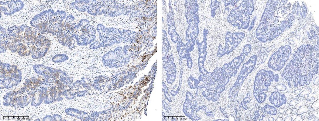 Recombinant Phospho-S6 Ribosomal Protein (Ser240, 244) Monoclonal Antibody - small - 2