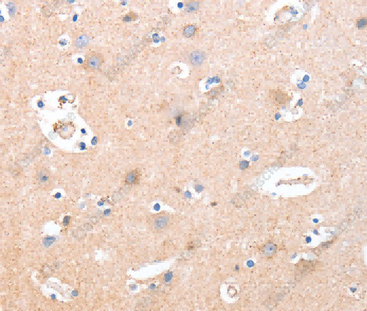 B3GAT1 Polyclonal Antibody - 3