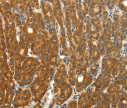 PTCH1 Polyclonal Antibody - 3