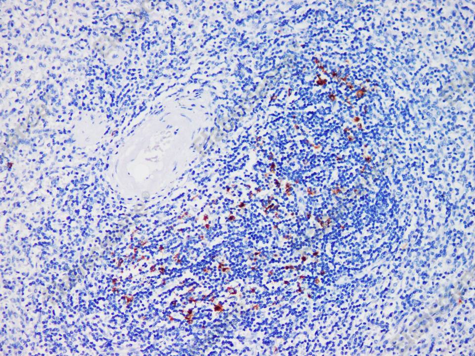 Recombinant CD208/DC-LAMP/LAMP3 Monoclonal Antibody - 1