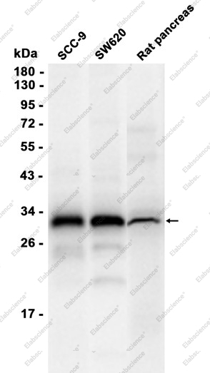 Recombinant TMEM192 Monoclonal Antibody - 2