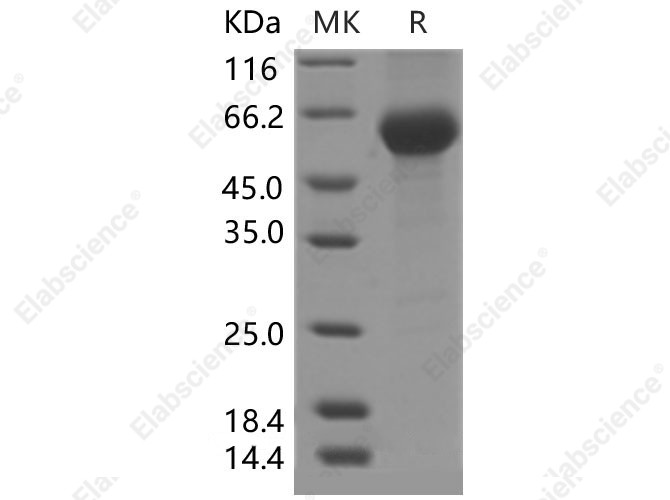 Recombinant Mouse PLA2G7/Lp-PLA2 Protein (His Tag) - 1