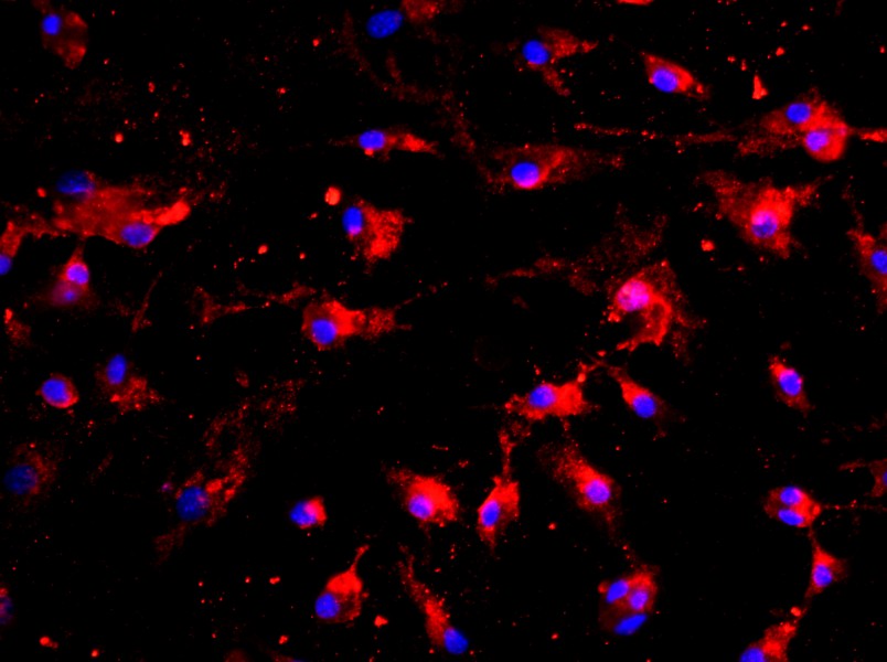 Rat Pulmonary Microvascular Endothelial Cell Complete Medium - 2