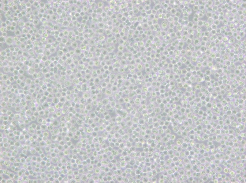 Ramos [RA 1] Cell Complete Medium - 4