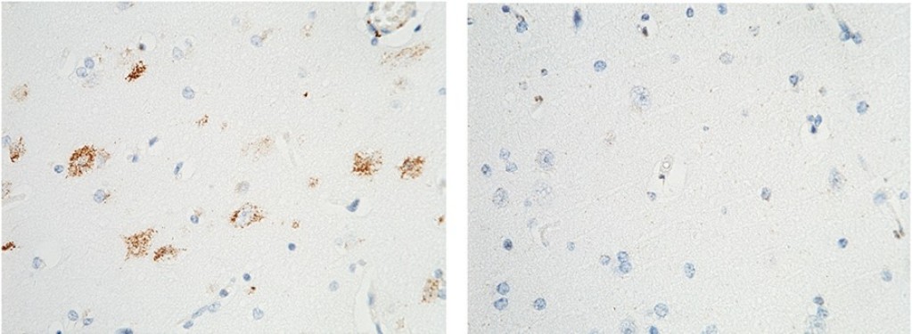 Recombinant TrkA/NTRK1 Monoclonal Antibody - small - 1