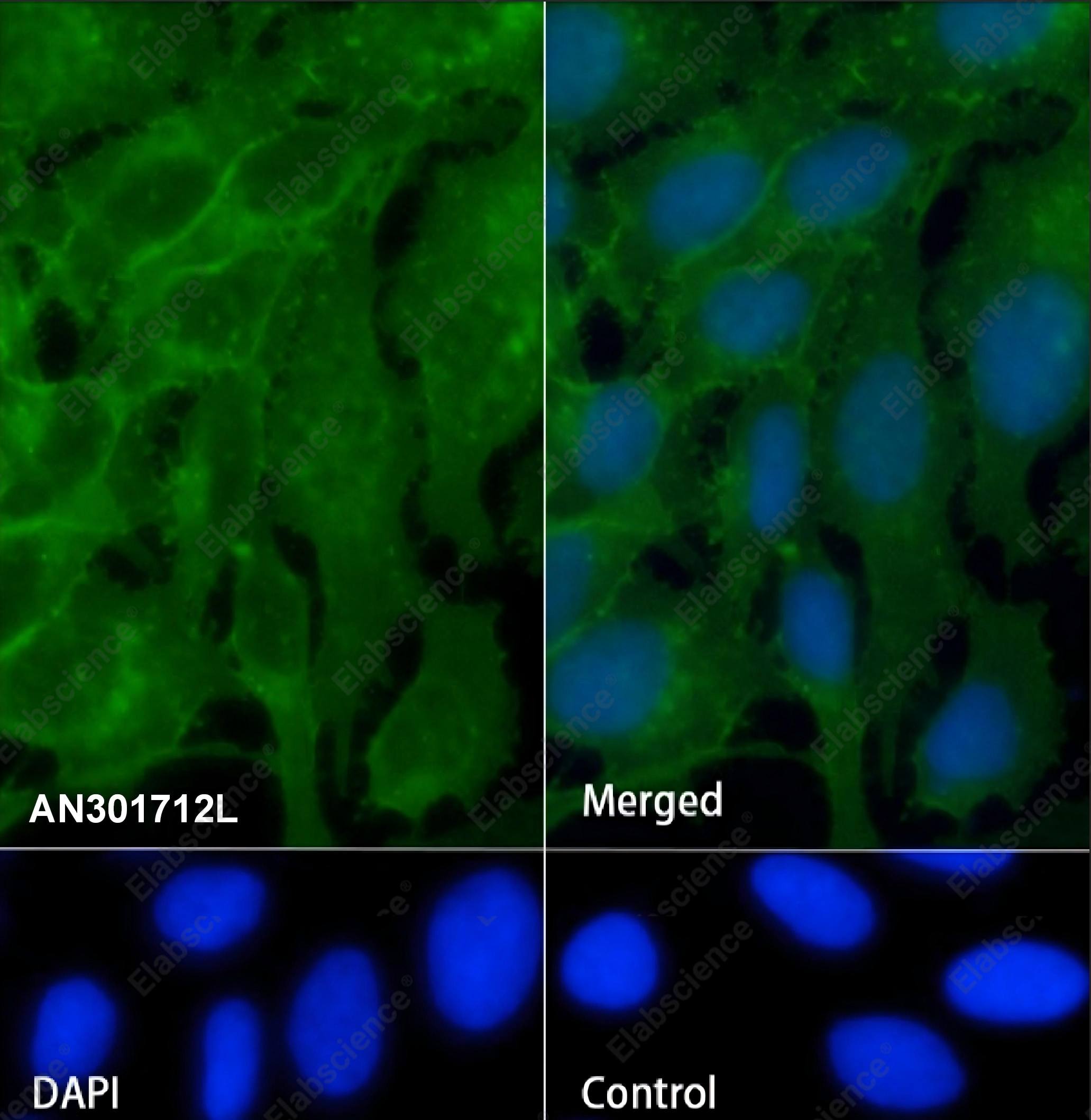 Recombinant Na+/K+ ATPase alpha-1 Monoclonal Antibody - 1