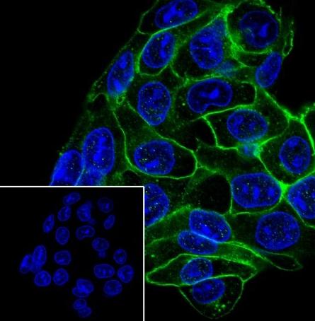 Recombinant Glypican-3 Monoclonal Antibody - small - 4