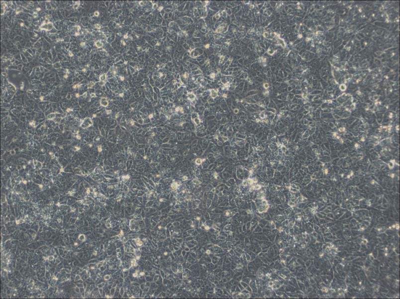 NTERA-2 Cell Complete Medium - 2