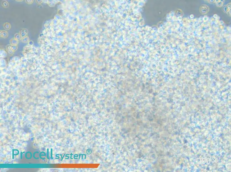 NCI-H2171 Cell Complete Medium - 4