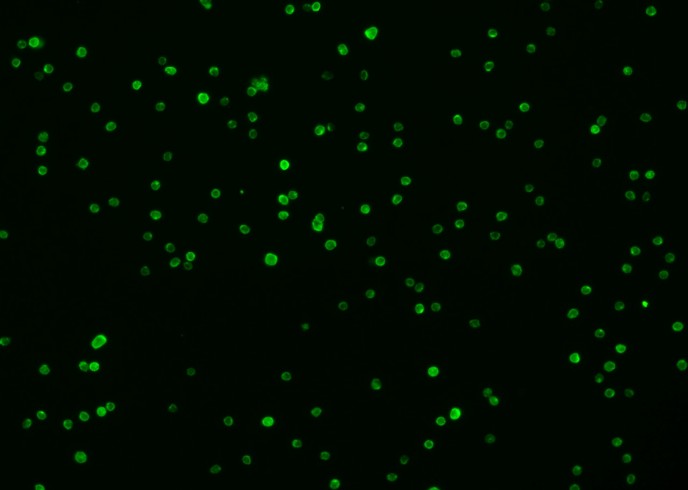 Recombinant Syndecan-4/SDC4 Monoclonal Antibody-searchlist-1