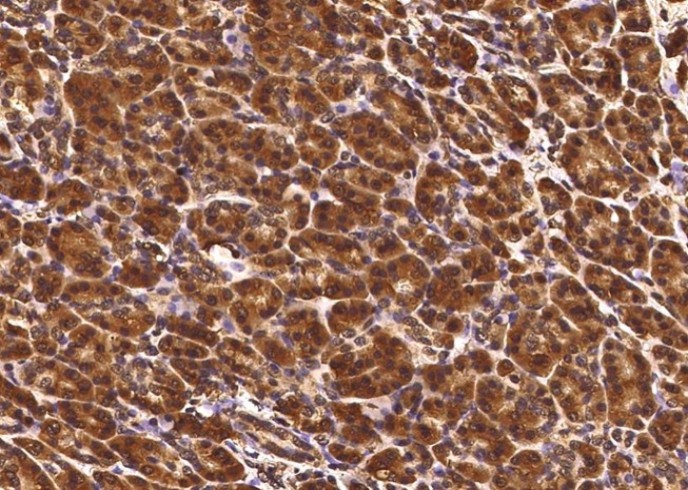 TCERG1L Monoclonal Antibody - small - 1