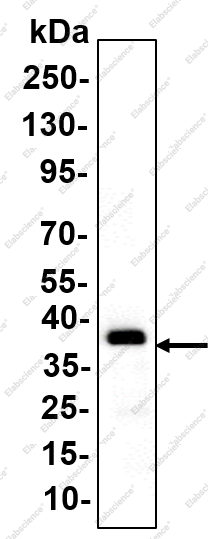 Recombinant AGTR1 Monoclonal Antibody - 1