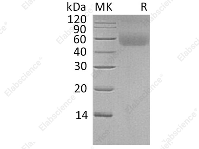 Recombinant Human LSAMP Protein (His Tag) - 1
