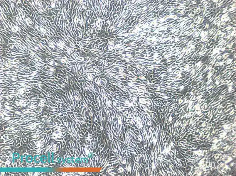 YUMM1.1 Cell Complete Medium - 1