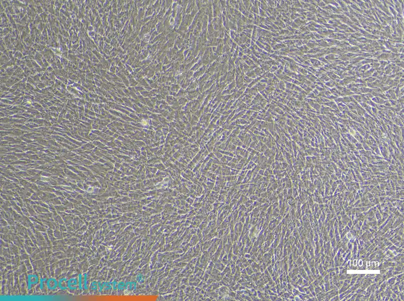 Rabbit Pulmonary Great Artery Smooth Muscle Cell Complete Medium - 3