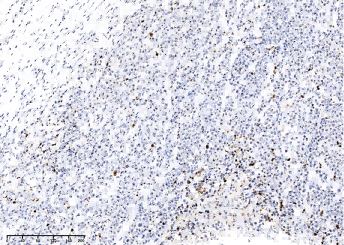 PARP-1 Monoclonal Antibody - small - 2