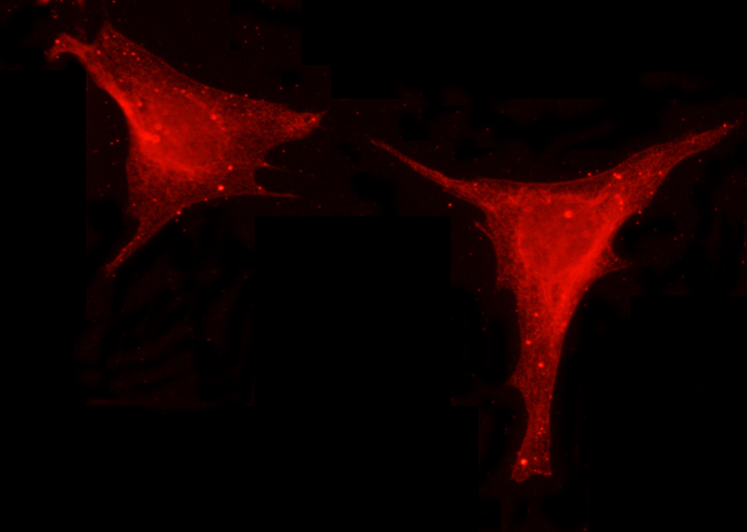 Recombinant Leptin/LEP Monoclonal Antibody - small - 2