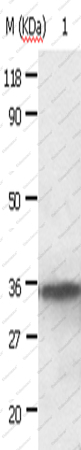 ANXA2 Polyclonal Antibody - 1
